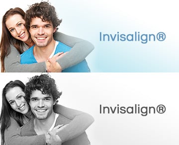 Invisalign